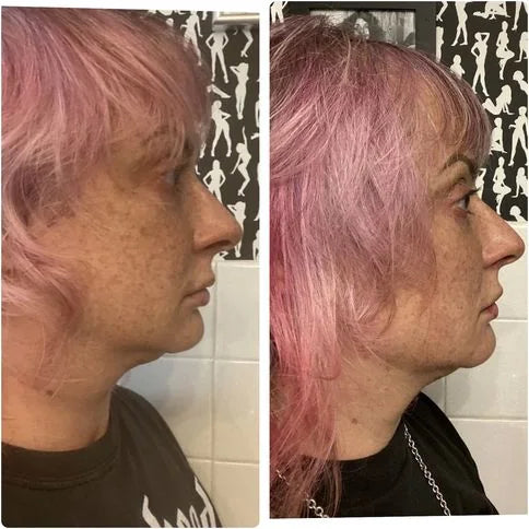 Maria H.’s own before and after, from a review of the Original Lumo