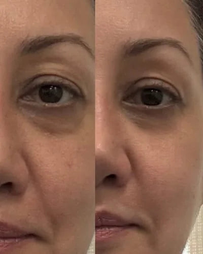 Sara S.’s own before and after, from a review of the Venus