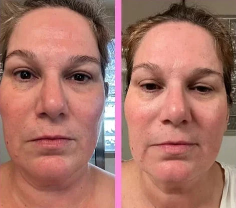 Chloe R.’s own before and after, from a review of the Trio kit