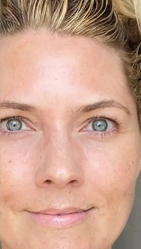 Before using the original Lumo: a woman's face