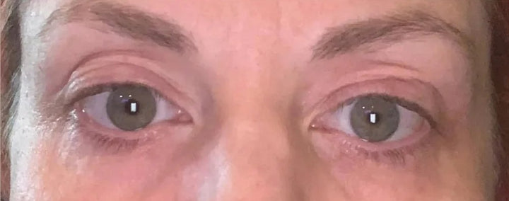 After 3 weeks with the Venus: a woman's eyes
