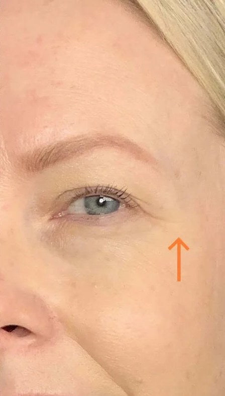After with the Venus: a woman’s eye area