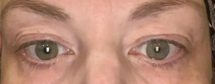 Before using the Venus: a woman's eyes